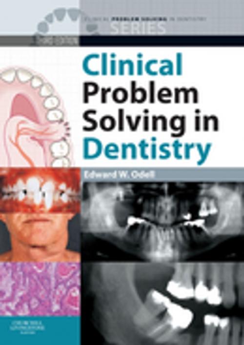 Cover of the book Clinical Problem Solving in Dentistry E-Book by , Elsevier Health Sciences