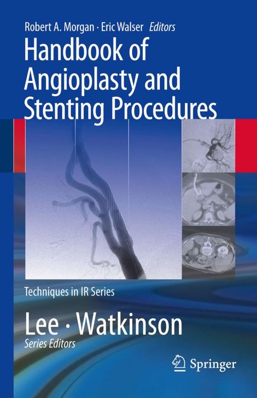 Cover of the book Handbook of Angioplasty and Stenting Procedures by , Springer London