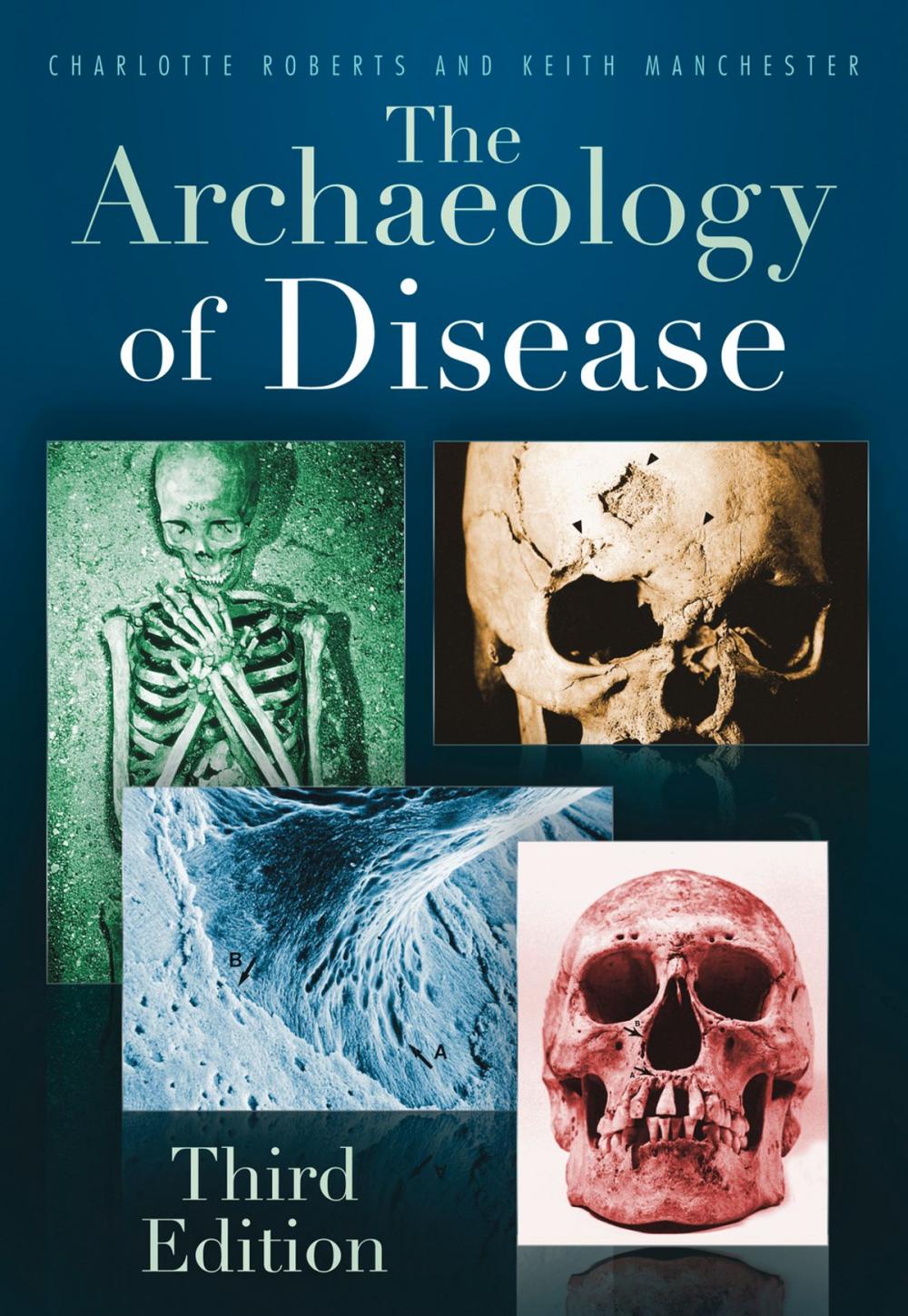 Big bigCover of Archaeology of Disease