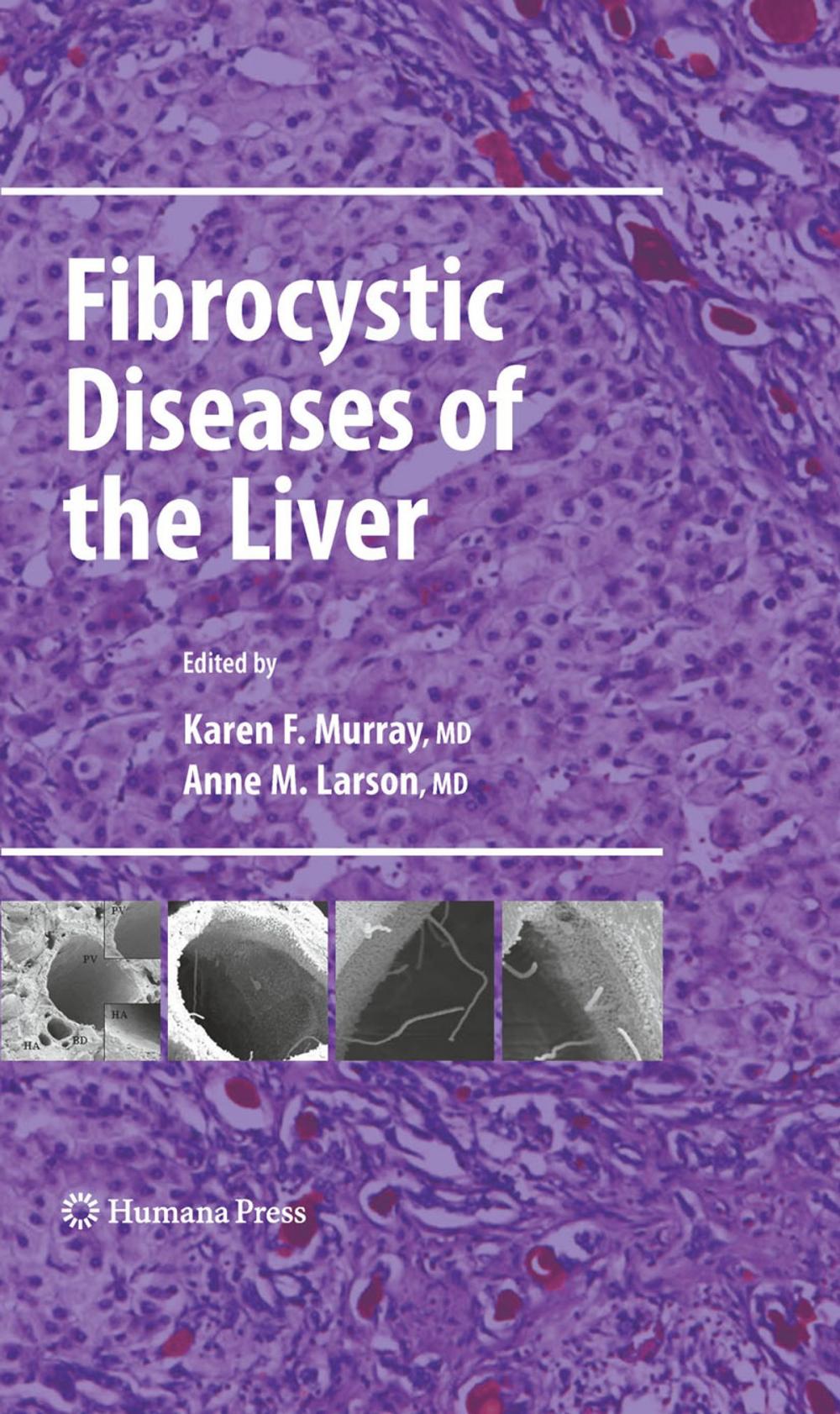 Big bigCover of Fibrocystic Diseases of the Liver