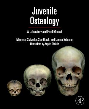 Cover of the book Juvenile Osteology by Elena Ibanez, Alejandro Cifuentes