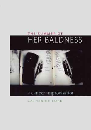 Cover of the book The Summer of Her Baldness by Thomas Bruneau, Lucía Dammert, Elizabeth Skinner