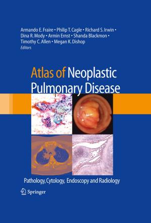 Cover of the book Atlas of Neoplastic Pulmonary Disease by Barry R. Parker