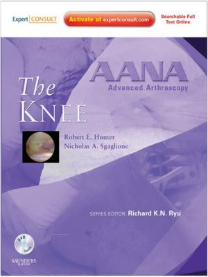 Cover of the book AANA Advanced Arthroscopy: The Knee E-Book by Sharon Stark, PhD, RN, APN-C