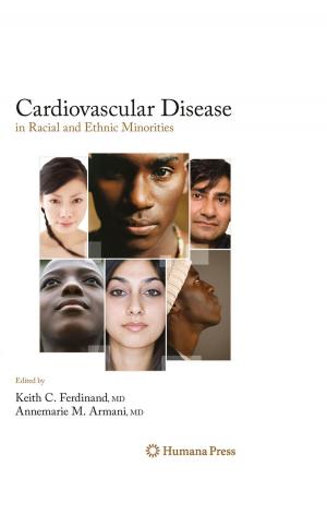 Cover of the book Cardiovascular Disease in Racial and Ethnic Minorities by Albert A. Luderer, Howard H. Weetall