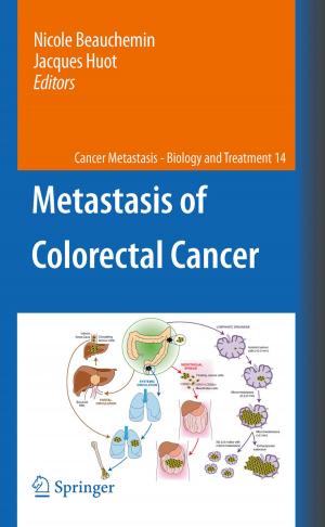 Cover of the book Metastasis of Colorectal Cancer by T.R. Paton