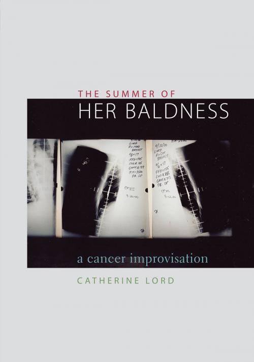 Cover of the book The Summer of Her Baldness by Catherine Lord, University of Texas Press