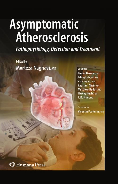 Cover of the book Asymptomatic Atherosclerosis by , Humana Press