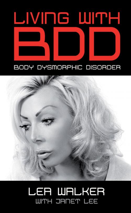 Cover of the book Living With Body Dysmorphic Disorder by Lea Walker, Andrews UK