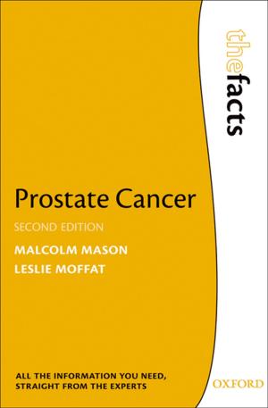 Cover of the book Prostate Cancer by Edith Penrose, Christos Pitelis