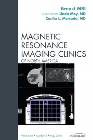Cover of the book Breast MRI, An Issue of Magnetic Resonance Imaging Clinics - E-Book by Darin T. Okuda, MD, FAAN, FANA.
