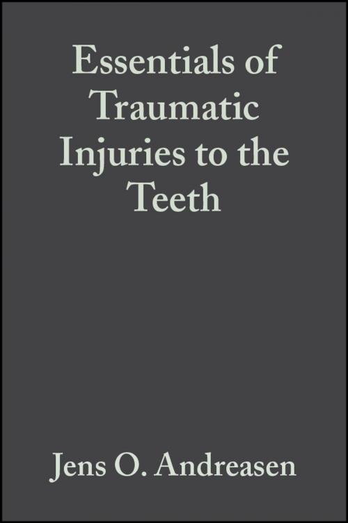 Cover of the book Essentials of Traumatic Injuries to the Teeth by Jens O. Andreasen, Frances M. Andreasen, Wiley