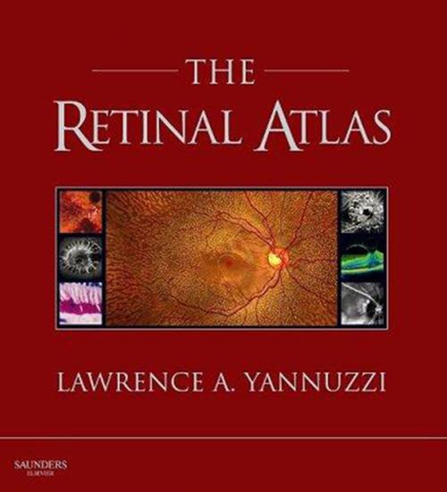Cover of the book The Retinal Atlas E-Book by Lawrence A. Yannuzzi, MD, Elsevier Health Sciences