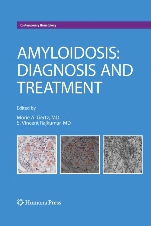 Cover of the book Amyloidosis by , Humana Press
