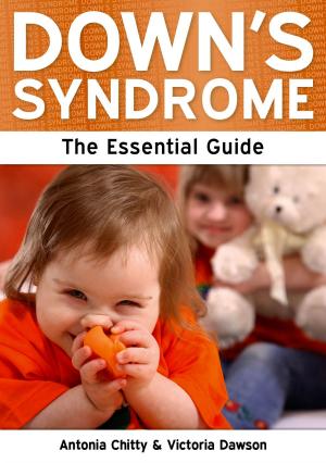 Book cover of Down's Syndrome: The Essential Guide