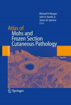Cover of the book Atlas of Mohs and Frozen Section Cutaneous Pathology by James B. Seward, William D. Edwards, Donald J. Hagler, A. Jamil Tajik