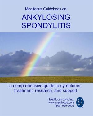 Book cover of Medifocus Guidebook On: Ankylosing Spondylitis