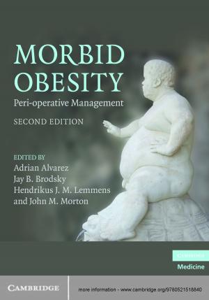 Cover of the book Morbid Obesity by Glenn Gamst, Lawrence S. Meyers, A. J. Guarino