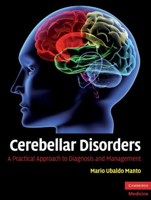 Cover of the book Cerebellar Disorders by Professor Margaret Brazier, Professor Suzanne Ost