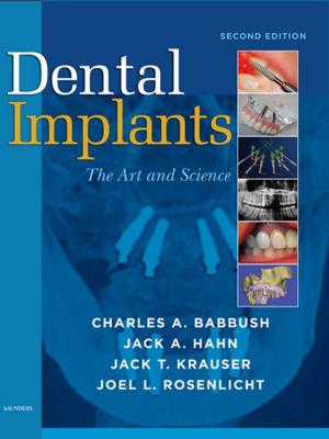 Cover of the book Dental Implants - E-Book by Paul Ridder