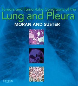Book cover of Tumors and Tumor-like Conditions of the Lung and Pleura E-Book
