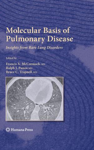 Cover of the book Molecular Basis of Pulmonary Disease by Jennifer C. Love, Sharon M. Derrick, Jason M. Wiersema