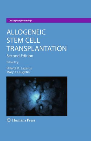 Cover of the book Allogeneic Stem Cell Transplantation by Antony D. Kidman, John K. Tomkins, Carol A. Morris, Neil A. Cooper