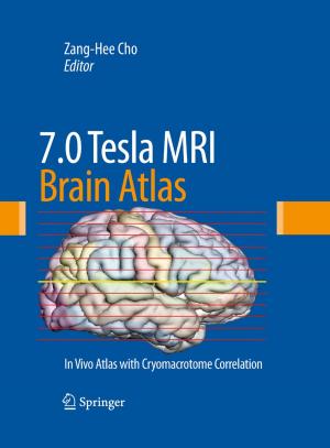 Cover of the book 7.0 Tesla MRI Brain Atlas by Francis A. Gunther