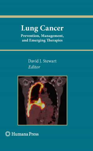 Cover of the book Lung Cancer: by 