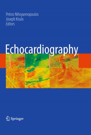 Cover of the book Echocardiography by Sholom M. Weiss, Nitin Indurkhya, Tong Zhang