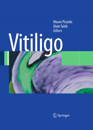 Cover of the book Vitiligo by Kristina Sommers