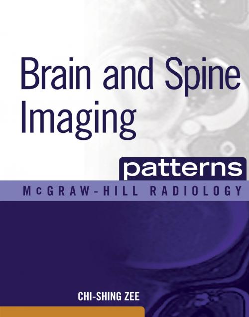 Cover of the book Brain and Spine Imaging Patterns by Chi-Shing Zee, McGraw-Hill Education