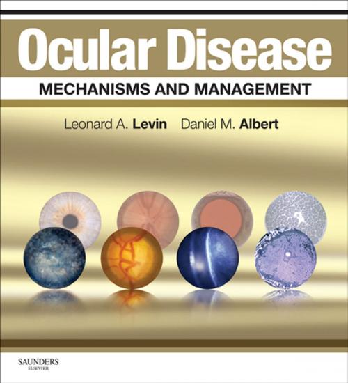 Cover of the book Ocular Disease: Mechanisms and Management E-Book by Leonard A Levin, MD, PhD, Daniel M. Albert, MD, MS, Elsevier Health Sciences