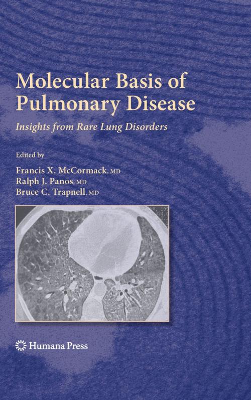 Cover of the book Molecular Basis of Pulmonary Disease by , Humana Press