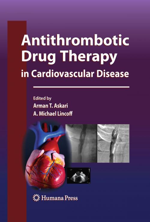 Cover of the book Antithrombotic Drug Therapy in Cardiovascular Disease by , Humana Press