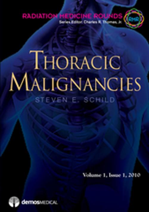 Cover of the book Thoracic Malignancies by Steven E. Schild, MD, Charles R. Thomas, MD, Springer Publishing Company