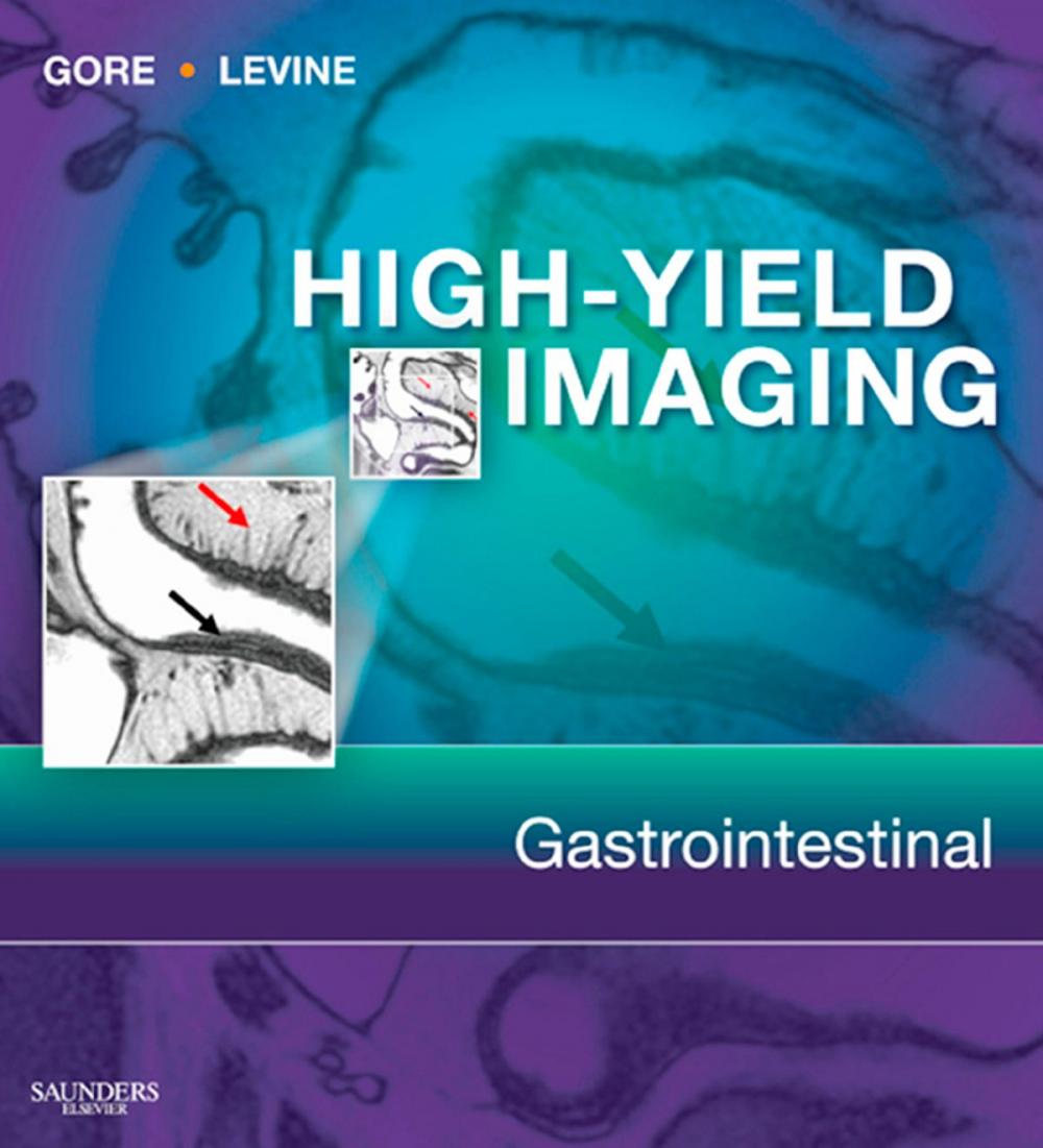 Big bigCover of High Yield Imaging Gastrointestinal E-Book