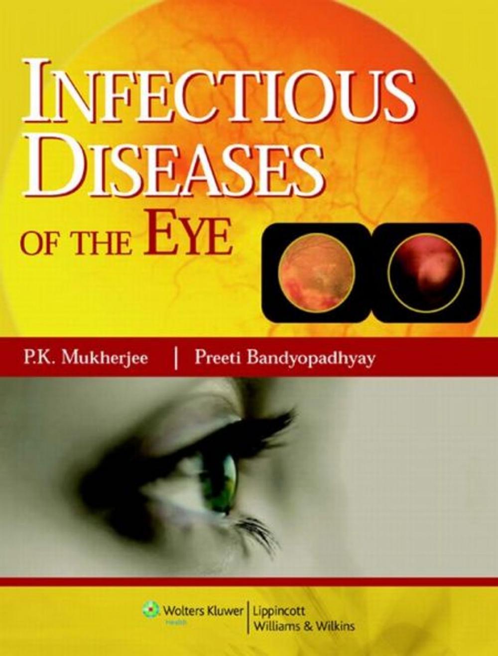 Big bigCover of Infectious diseases of the Eyes