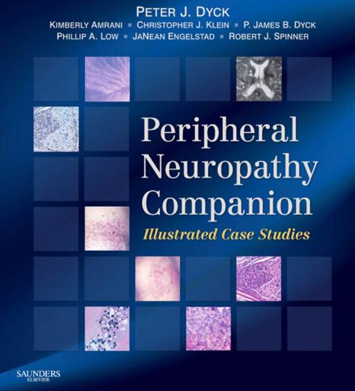 Cover of the book Companion to Peripheral Neuropathy E-Book by Peter James Dyck, MD, P. James B. Dyck, Christopher J. Klein, Phillip Low, Kimberly Amrami, MD, JaNean Engelstad, Robert J. Spinner, MD, Elsevier Health Sciences
