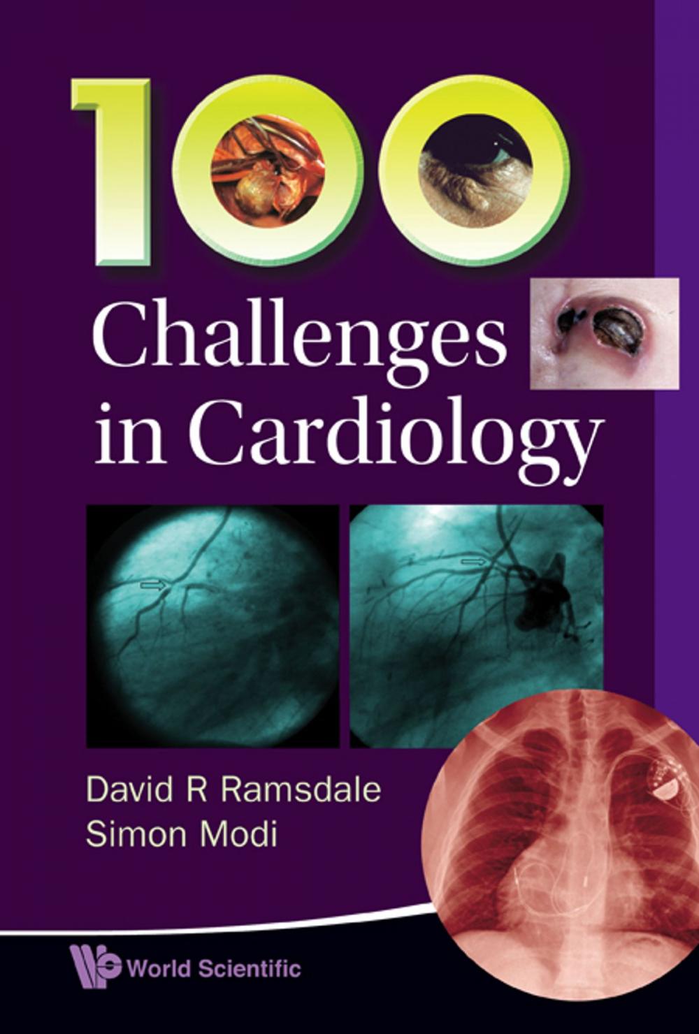 Big bigCover of 100 Challenges in Cardiology