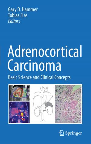 Cover of the book Adrenocortical Carcinoma by Manuel Hidalgo, S. Gail Eckhardt, Neil J. Clendeninn
