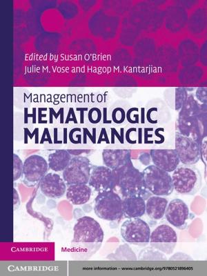 Cover of the book Management of Hematologic Malignancies by Martin Hogg