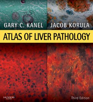 Cover of the book Atlas of Liver Pathology E-Book by Patricia K. Burkhart, PhD, RN
