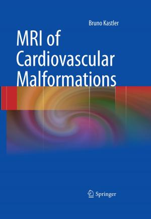 Cover of the book MRI of Cardiovascular Malformations by Reinhold Noé