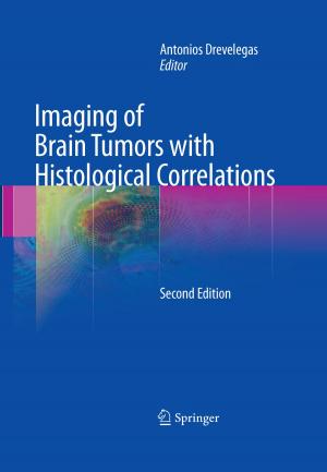 Cover of the book Imaging of Brain Tumors with Histological Correlations by 