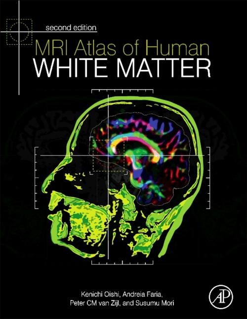 Cover of the book MRI Atlas of Human White Matter by Susumu Mori, Peter C M van Zijl, Kenichi Oishi, Andreia V. Faria, Elsevier Science