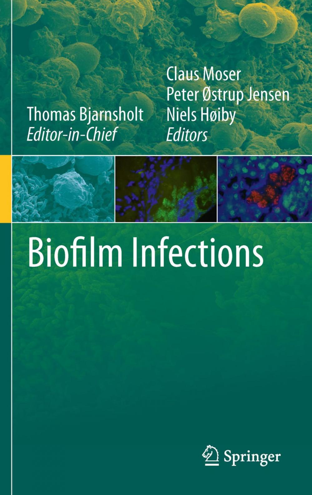 Big bigCover of Biofilm Infections