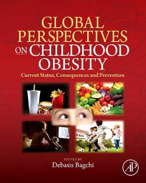 Cover of the book Global Perspectives on Childhood Obesity by 