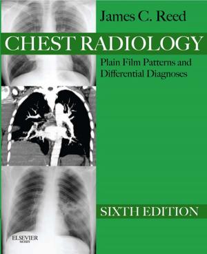 Cover of the book Chest Radiology Plain Film Patterns and Differential Diagnoses E-Book by Steven D. Waldman, MD, JD
