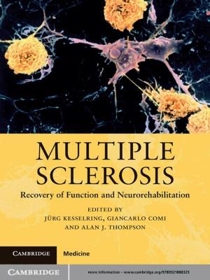 Cover of the book Multiple Sclerosis by Gerald Brenan